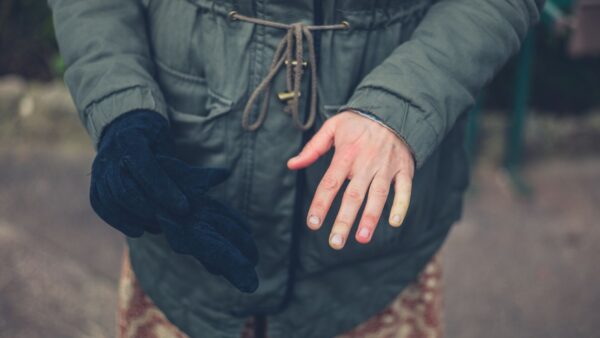 Learn tips and tricks for Raynaud's treatment