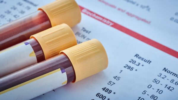 Find out if your ESR means inflammation in rheumatology