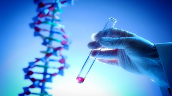 The HLAB27 genetic test can be used to confirm a diagnosis of Ankylosing Spondylitis