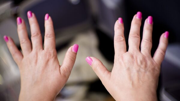 Lupus hand symptoms can be confusing and have a significant impact on your life